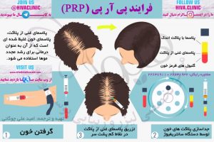 پی آر پی (PRP)