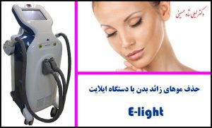 دستگاه ایلایت